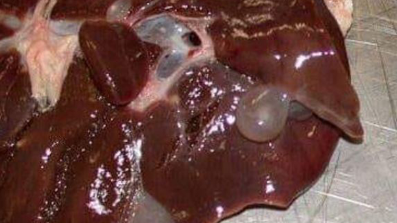 Experts Urge Unified Health Records for Cystic Echinococcosis Control